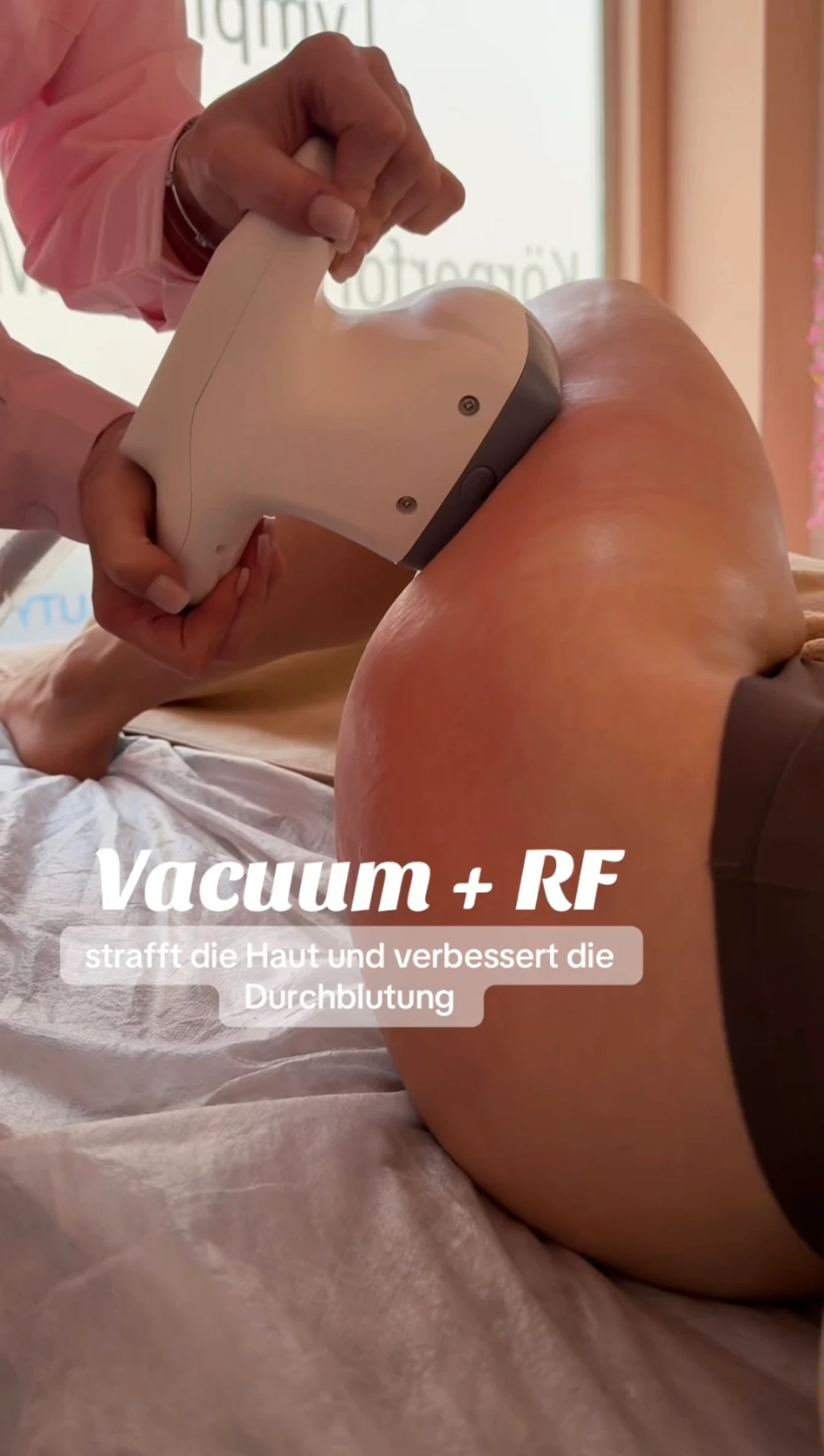 Vakuum Massage mit RF – Behandlung im Body Beauty Studio in München